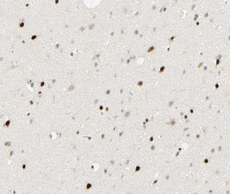 FOXJ3 Antibody - 1:100 staining human brain tissue by IHC-P. The tissue was formaldehyde fixed and a heat mediated antigen retrieval step in citrate buffer was performed. The tissue was then blocked and incubated with the antibody for 1.5 hours at 22°C. An HRP conjugated goat anti-rabbit antibody was used as the secondary.