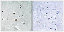 FOXJ3 Antibody - Peptide - + Immunohistochemistry analysis of paraffin-embedded human brain tissue using FOXJ3 antibody.