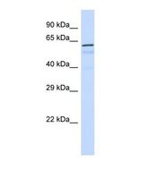 FOXK1 / MNF Antibody - Western blot of Human Placenta. FOXK1 antibody dilution 1.0 ug/ml.  This image was taken for the unconjugated form of this product. Other forms have not been tested.