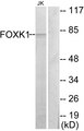 FOXK1 / MNF Antibody - Western blot analysis of lysates from Jurkat cells, using FOXK1 Antibody. The lane on the right is blocked with the synthesized peptide.