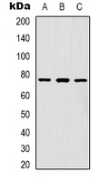 FOXK1 / MNF Antibody - Western blot analysis of FOXK1 expression in HeLa (A); A431 (B); Jurkat (C) whole cell lysates.