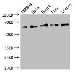 FOXK1 / MNF Antibody - Positive WB detected in:HEK293 whole cell lysate,Hela whole cell lysate,Mouse heart tissue,Mouse lung tissue,Mouse kidney tissue;All lanes:FOXK1 antibody at 2.5ug/ml;Secondary;Goat polyclonal to rabbit IgG at 1/50000 dilution;Predicted band size: 76,60 kDa;Observed band size: 76 kDa;