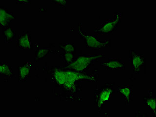 FOXK1 / MNF Antibody - Immunofluorescent analysis of U251 cells using FOXK1 Antibody at a dilution of 1:100 and Alexa Fluor 488-congugated AffiniPure Goat Anti-Rabbit IgG(H+L)