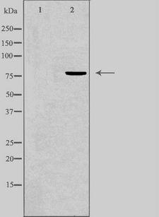 FOXK1 / MNF Antibody - Western blot analysis of extracts of Jurkat cells using FOXK1 antibody. The lane on the left is treated with the antigen-specific peptide.