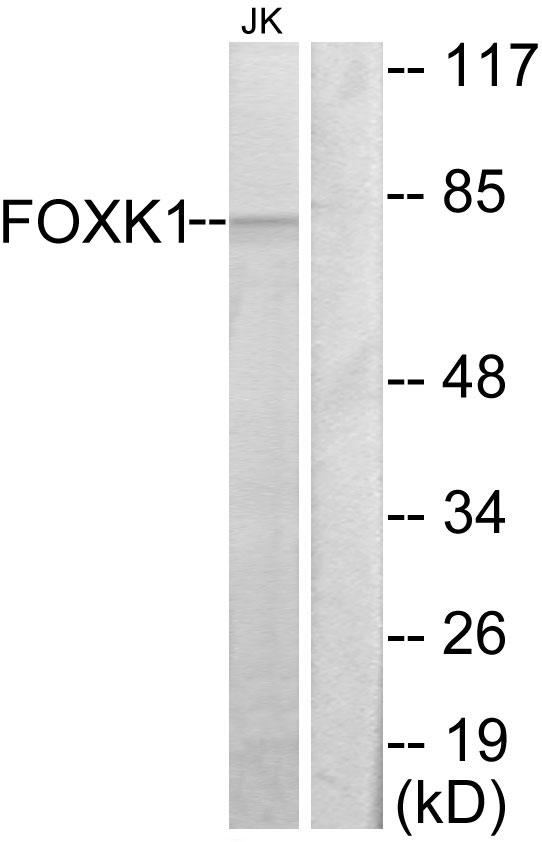 FOXK1 / MNF Antibody - Western blot analysis of extracts from Jurkat cells, using FOXK1 antibody.
