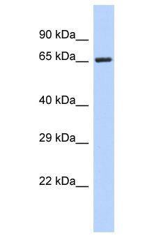FOXK2 / ILF Antibody - FOXK2 / ILF antibody Western Blot of MCF7. Antibody dilution: 1 ug/ml.  This image was taken for the unconjugated form of this product. Other forms have not been tested.