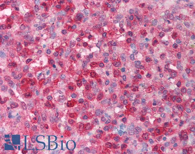 FOXK2 / ILF Antibody - Human Spleen (formalin-fixed, paraffin-embedded) stained with FOXK2 antibody LS-B1529 at 5 ug/ml followed by biotinylated goat anti-rabbit IgG secondary antibody, alkaline phosphatase-streptavidin and chromogen.  This image was taken for the unconjugated form of this product. Other forms have not been tested.