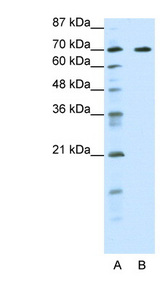 FOXK2 / ILF Antibody - FOXK2 antibody Western blot of HepG2 cell lysate. This image was taken for the unconjugated form of this product. Other forms have not been tested.