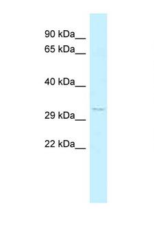 FOXK2 / ILF Antibody - FOXK2 antibody Western blot of 293T Cell lysate. Antibody concentration 1 ug/ml.  This image was taken for the unconjugated form of this product. Other forms have not been tested.