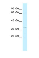 FOXK2 / ILF Antibody - FOXK2 antibody Western blot of 293T Cell lysate. Antibody concentration 1 ug/ml.  This image was taken for the unconjugated form of this product. Other forms have not been tested.