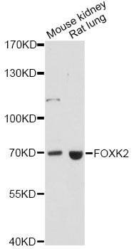FOXK2 / ILF Antibody - Western blot analysis of extracts of various cell lines, using FOXK2 antibody at 1:1000 dilution. The secondary antibody used was an HRP Goat Anti-Rabbit IgG (H+L) at 1:10000 dilution. Lysates were loaded 25ug per lane and 3% nonfat dry milk in TBST was used for blocking. An ECL Kit was used for detection and the exposure time was 90s.