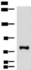 FOXK2 / ILF Antibody - Western blot analysis of TM4 cell lysate  using FOXK2 Polyclonal Antibody at dilution of 1:1000