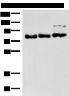 FOXK2 / ILF Antibody - Western blot analysis of 231 A172 and HepG2 cell lysates  using FOXK2 Polyclonal Antibody at dilution of 1:800