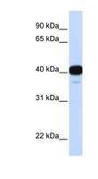 FOXL1 Antibody - FOXL1 antibody Western blot of Fetal Heart lysate. This image was taken for the unconjugated form of this product. Other forms have not been tested.