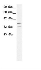 FOXL1 Antibody - Fetal Liver Lysate.  This image was taken for the unconjugated form of this product. Other forms have not been tested.