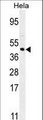 FOXL2 Antibody - FOXL2 Antibody western blot of HeLa cell line lysates (35 ug/lane). The FOXL2 antibody detected the FOXL2 protein (arrow).