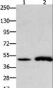 FOXL2 Antibody - Western blot analysis of Mouse brain and heart tissue, using FOXL2 Polyclonal Antibody at dilution of 1:750.