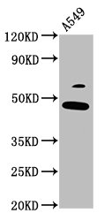 FOXL2 Antibody - Positive Western Blot detected in A549 whole cell lysate. All lanes: FOXL2 antibody at 3.7 µg/ml Secondary Goat polyclonal to rabbit IgG at 1/50000 dilution. Predicted band size: 39 KDa. Observed band size: 49 KDa