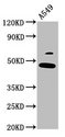 FOXL2 Antibody - Positive Western Blot detected in A549 whole cell lysate. All lanes: FOXL2 antibody at 3.7 µg/ml Secondary Goat polyclonal to rabbit IgG at 1/50000 dilution. Predicted band size: 39 KDa. Observed band size: 49 KDa