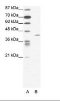 FOXL2 Antibody - A: Marker, B: Jurkat Cell Lysate.  This image was taken for the unconjugated form of this product. Other forms have not been tested.