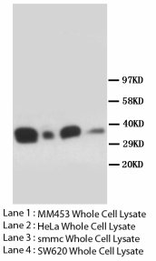 FOXL2 Antibody -  This image was taken for the unconjugated form of this product. Other forms have not been tested.