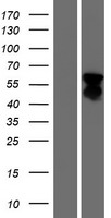 FOXL2 Protein - Western validation with an anti-DDK antibody * L: Control HEK293 lysate R: Over-expression lysate