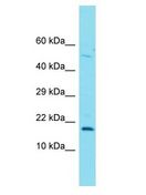 FOXL2NB Antibody - C3orf72 antibody Western Blot of PANC1. Antibody dilution: 1 ug/ml.  This image was taken for the unconjugated form of this product. Other forms have not been tested.