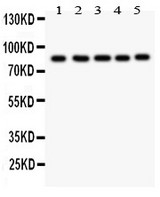 FOXM1 Antibody - FOXM1 antibody Western blot. All lanes: Anti FOXM1 at 0.5 ug/ml. Lane 1: HELA Whole Cell Lysate at 40 ug. Lane 2: COLO320 Whole Cell Lysate at 40 ug. Lane 3: SW620 Whole Cell Lysate at 40 ug. Lane 4: SKOV Whole Cell Lysate at 40 ug. Lane 5: MCD-7 Whole Cell Lysate at 40 ug. Predicted band size: 84 kD. Observed band size: 84 kD.