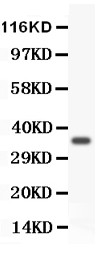 FOXM1 Antibody - FOXM1 antibody Western blot. All lanes: Anti FOXM1 at 0.5 ug/ml. WB: Recombinant Human FOXM1 Protein 0.5ng. Predicted band size: 36 kD. Observed band size: 36 kD.