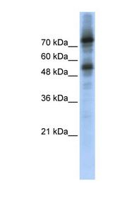FOXM1 Antibody - FOXM1 antibody Western blot of Transfected 293T cell lysate. This image was taken for the unconjugated form of this product. Other forms have not been tested.