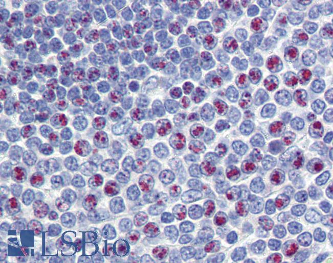 FOXM1 Antibody - Anti-FOXM1 antibody IHC of human spleen. Immunohistochemistry of formalin-fixed, paraffin-embedded tissue after heat-induced antigen retrieval. Antibody concentration 5 ug/ml.  This image was taken for the unconjugated form of this product. Other forms have not been tested.