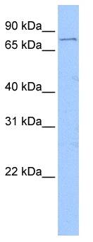 FOXM1 Antibody - Western analysis of Jurkat cell lysate.  This image was taken for the unconjugated form of this product. Other forms have not been tested.