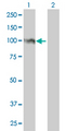 FOXM1 Antibody - Western Blot analysis of FOXM1 expression in transfected 293T cell line by FOXM1 monoclonal antibody (M01), clone 3A9.Lane 1: FOXM1 transfected lysate(84 KDa).Lane 2: Non-transfected lysate.