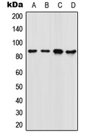 FOXM1 Antibody - Western blot analysis of FOXM1 expression in SW480 (A); 22RV1 (B); NIH3T3 (C); rat colon (D) whole cell lysates.