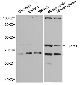 FOXM1 Antibody - Western blot analysis of extracts of various cell lines, using FOXM1 antibody.