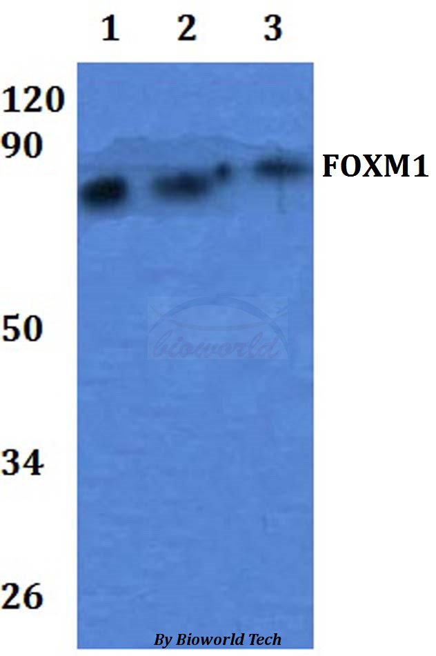 FOXM1 Antibody - Western blot of FOXM1antibody at 1:500 dilution. Lane 1: OVCAR3 whole cell lysate. Lane 2: Raw264.7 whole cell lysate. Lane 3: H9C2 whole cell lysate.