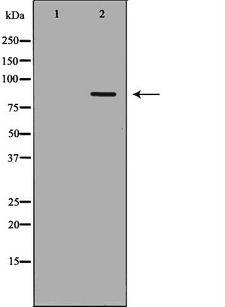 FOXM1 Antibody - Western blot analysis of mouse spleen lysate using FOXM1 antibody. The lane on the left is treated with the antigen-specific peptide.