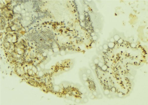 FOXM1 Antibody - 1:100 staining mouse colon tissue by IHC-P. The sample was formaldehyde fixed and a heat mediated antigen retrieval step in citrate buffer was performed. The sample was then blocked and incubated with the antibody for 1.5 hours at 22°C. An HRP conjugated goat anti-rabbit antibody was used as the secondary.