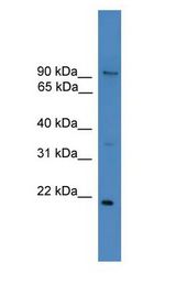 FOXM1 Antibody - FOXM1 antibody Western Blot of THP-1 cell lysate.  This image was taken for the unconjugated form of this product. Other forms have not been tested.