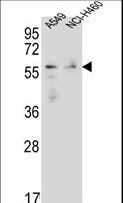 FOXN1 Antibody - FOXN1 Antibody western blot of A549,NCI-H460 cell line lysates (35 ug/lane). The FOXN1 antibody detected the FOXN1 protein (arrow).
