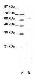 FOXN1 Antibody - A: Marker, B: Raji Cell Lysate.  This image was taken for the unconjugated form of this product. Other forms have not been tested.