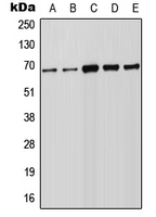 FOXN1 Antibody - Western blot analysis of FOXN1 expression in Raji (A); HeLa (B); A549 (C); NIH3T3 (D); PC12 (E) whole cell lysates.
