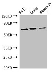 FOXN1 Antibody - Western Blot Positive WB detected in: Raji whole cell lysate, Mouse lung tissue, Mouse stomach tissue All lanes: FOXN1 antibody at 2.7µg/ml Secondary Goat polyclonal to rabbit IgG at 1/50000 dilution Predicted band size: 69 kDa Observed band size: 69 kDa
