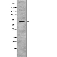 FOXN1 Antibody - Western blot analysis FOXN1 using Jurkat whole cells lysates