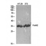 FOXN2 Antibody - Western blot of FoxN2 antibody
