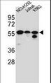 FOXN2 Antibody - FOXN2 Antibody western blot of NCI-H292,Jurkat,K562 cell line lysates (35 ug/lane). The FOXN2 antibody detected the FOXN2 protein (arrow).