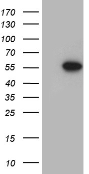 FOXN2 Antibody - HEK293T cells were transfected with the pCMV6-ENTRY control. (Left lane) or pCMV6-ENTRY FOXN2. (Right lane) cDNA for 48 hrs and lysed