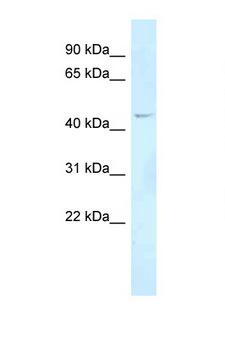 FOXN2 Antibody - FOXN2 antibody Western blot of COL0205 Cell lysate. Antibody concentration 1 ug/ml.  This image was taken for the unconjugated form of this product. Other forms have not been tested.
