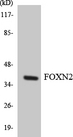 FOXN2 Antibody - Western blot analysis of the lysates from K562 cells using FOXN2 antibody.