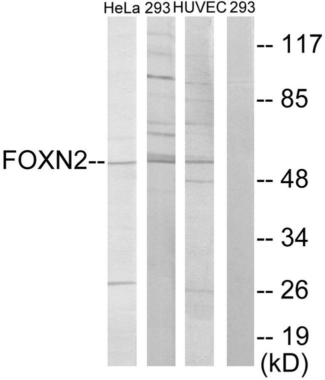 FOXN2 Antibody - Western blot analysis of lysates from HeLa, 293, and HUVEC cells, using FOXN2 Antibody. The lane on the right is blocked with the synthesized peptide.